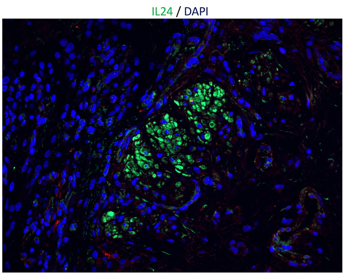 Human IL‑24 Antibody AF1965
