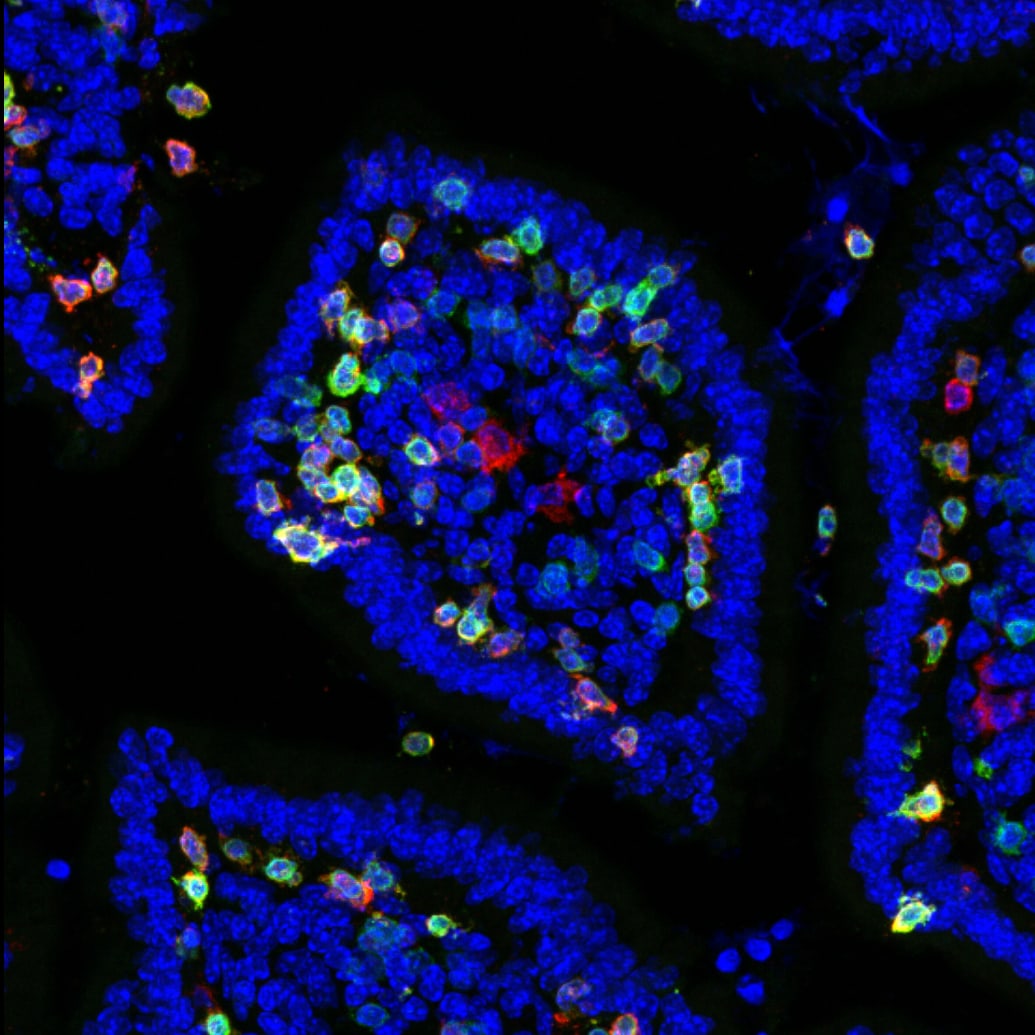 Mouse Integrin  alpha E/CD103 Antibody AF1990