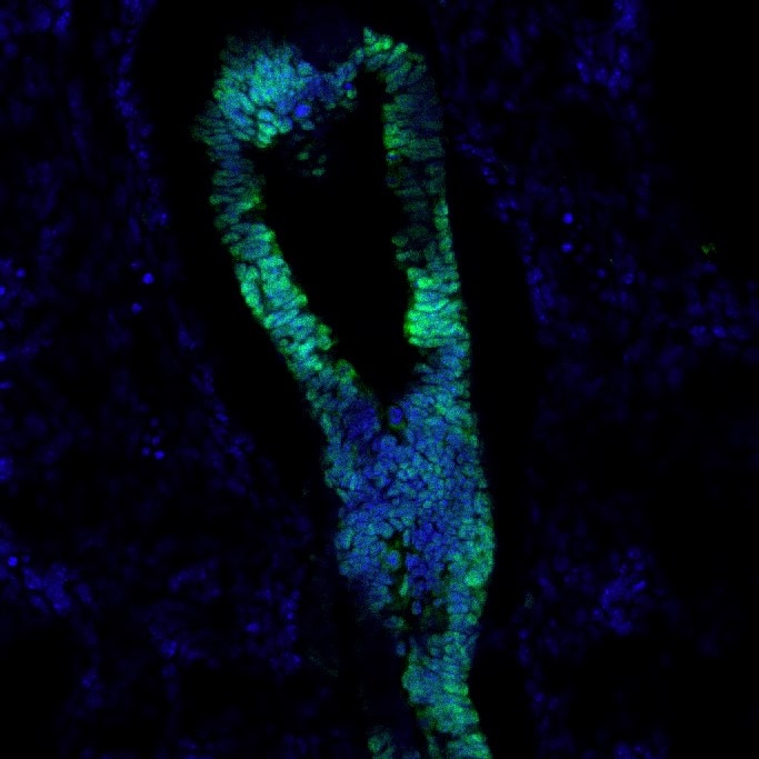 Human/Mouse/Rat SOX2 Antibody AF2018