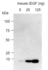 Mouse EGF Antibody AF2028