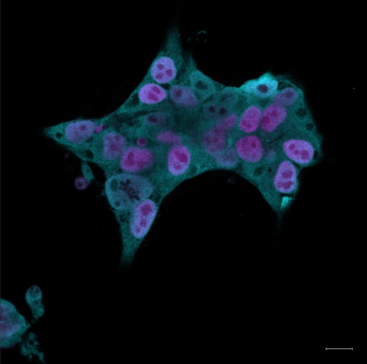 Human Smad1 Antibody AF2039