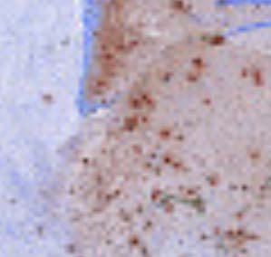 Mouse S100A9 Antibody AF2065
