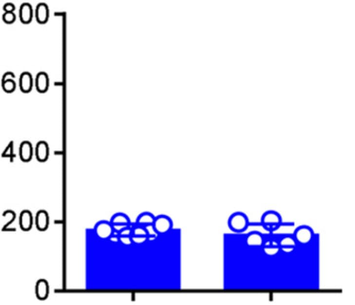 Mouse S100A9 Antibody AF2065