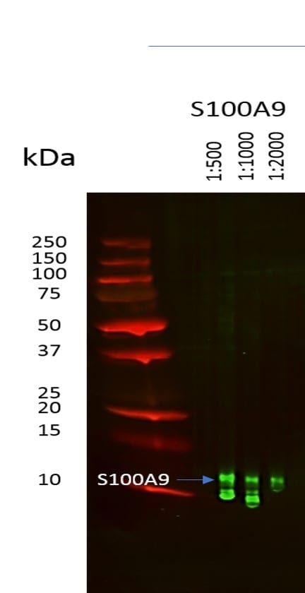Mouse S100A9 Antibody AF2065