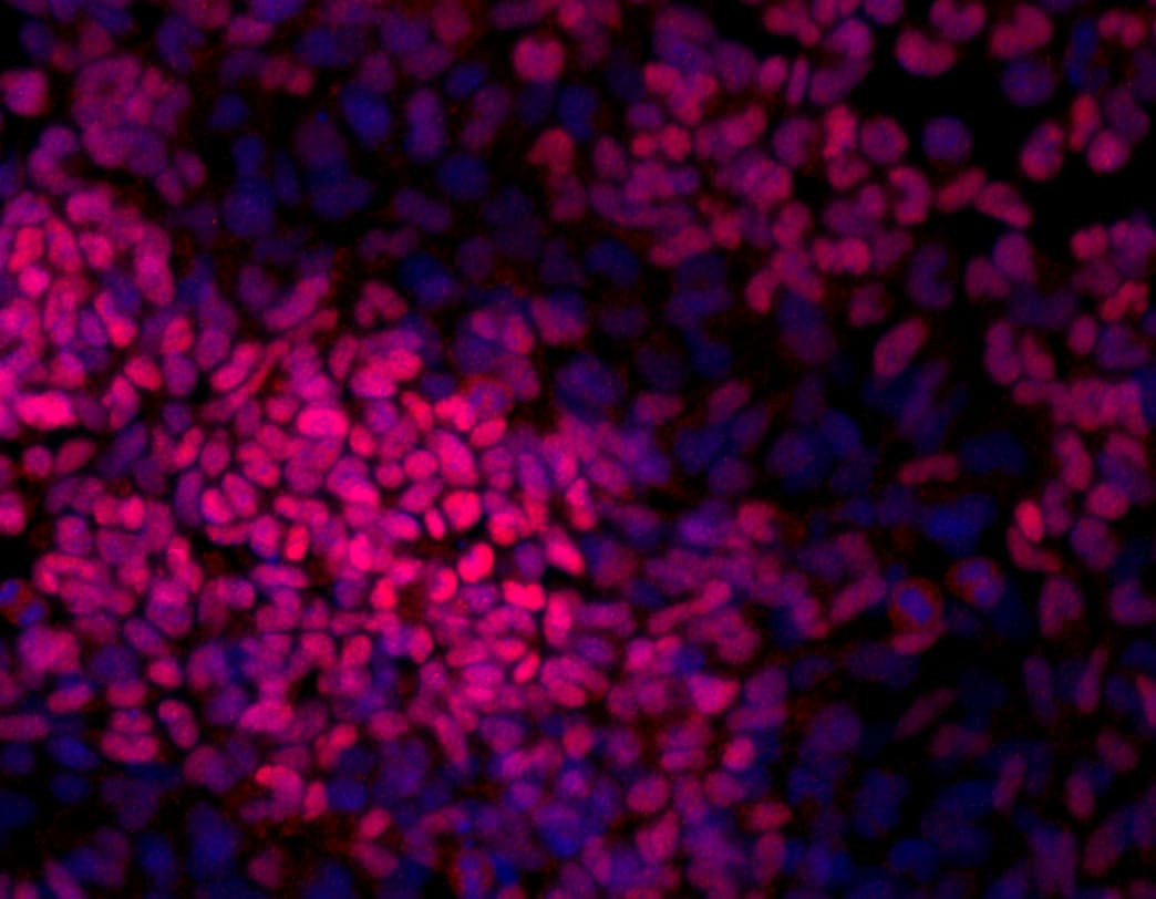 Human/Mouse Brachyury Antibody AF2085