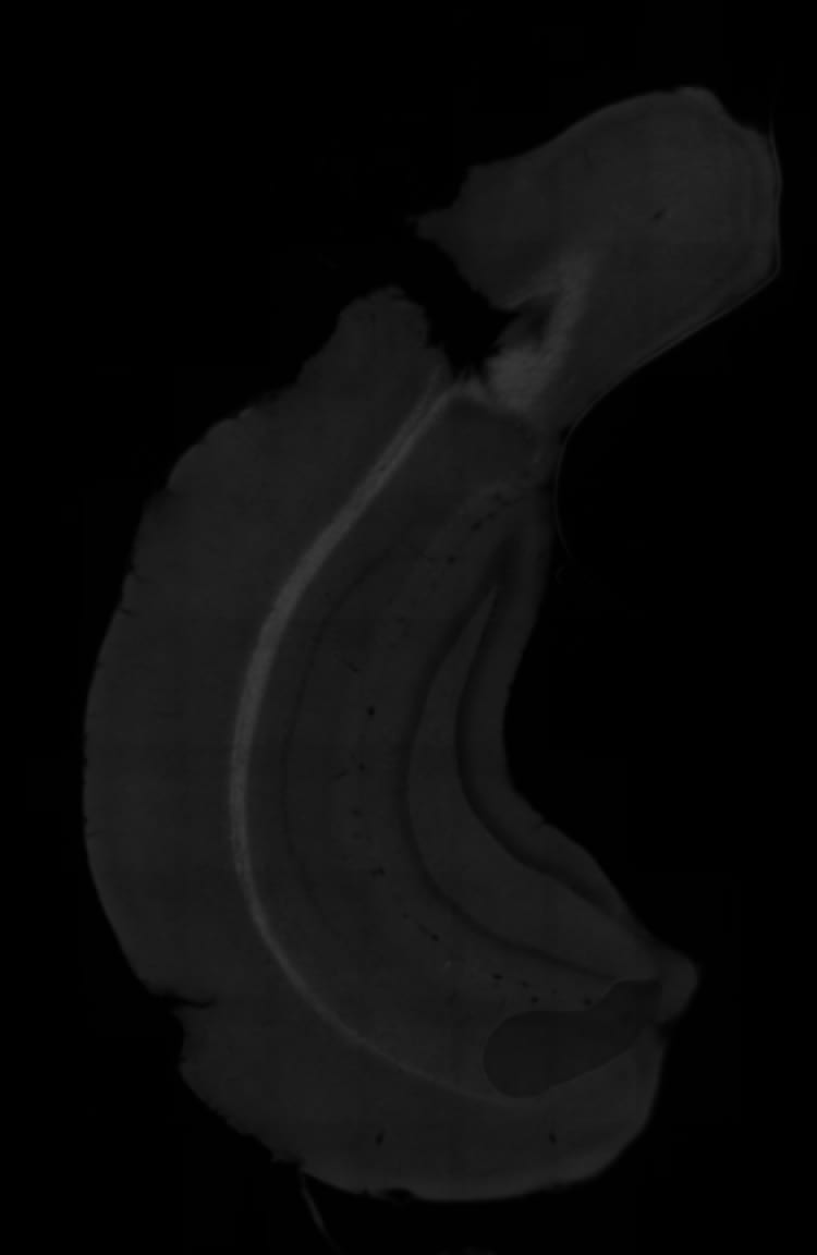 Human/Mouse/Rat GAD1/GAD67 Antibody AF2086