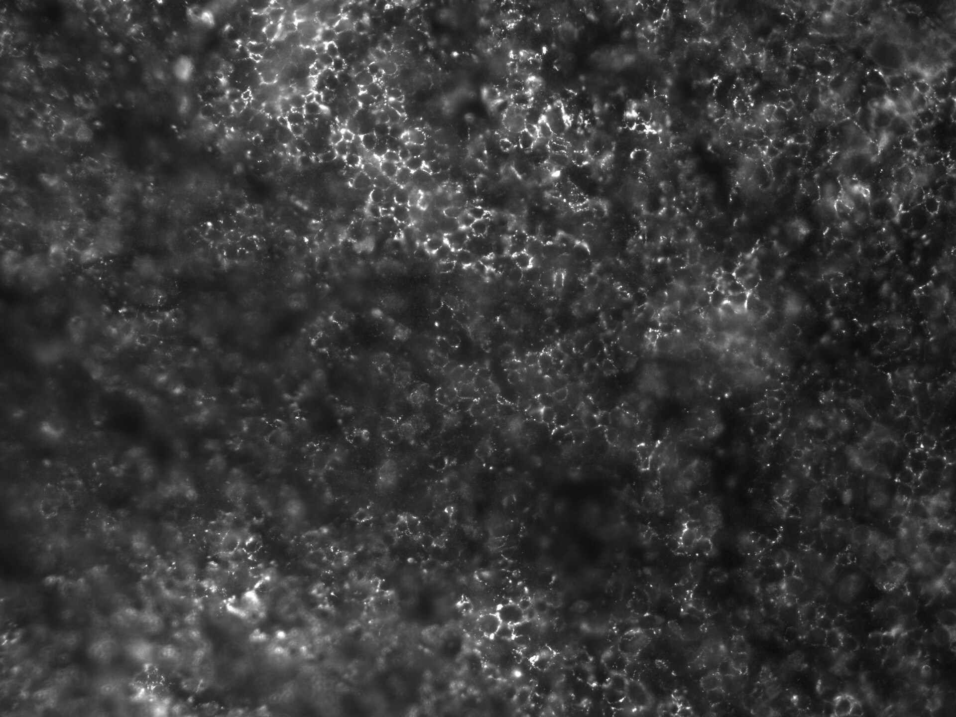 Human FCRL5/FcRH5 Antibody AF2087