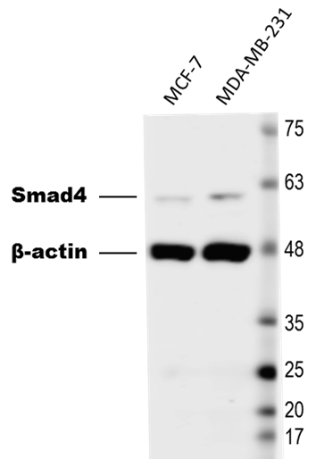 Human Smad4 Antibody AF2097