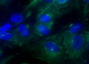Human TSG‑6 Antibody AF2104