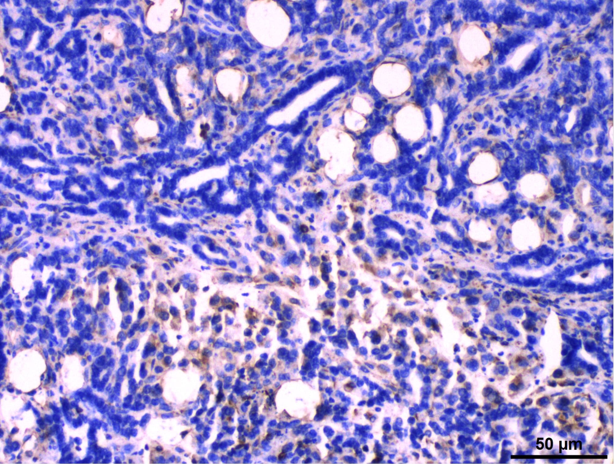 Human/Mouse/Rat Vimentin Antibody AF2105