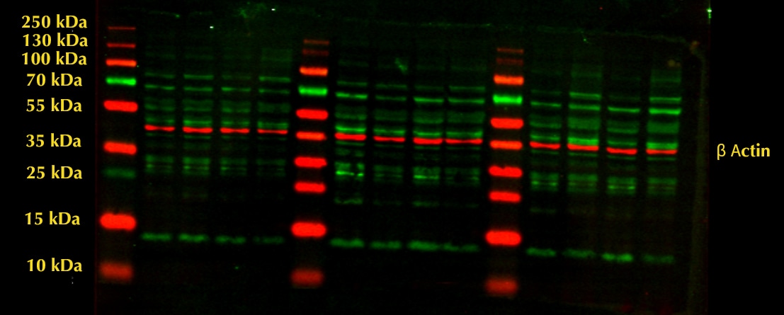 Human/Mouse/Rat Vimentin Antibody AF2105
