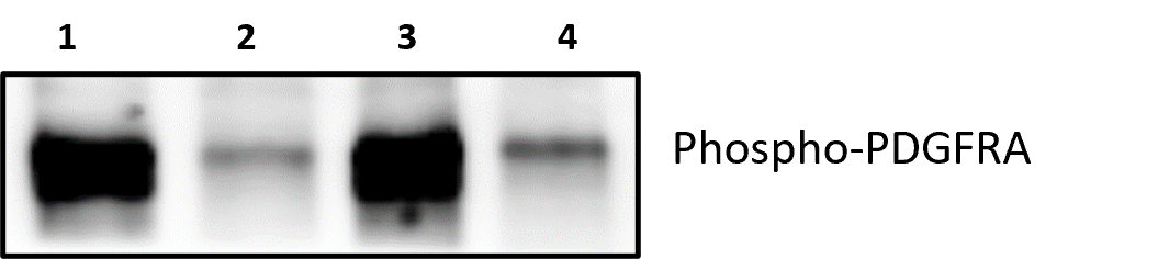 Human Phospho-PDGF R alpha  (Y762) Antibody AF21141