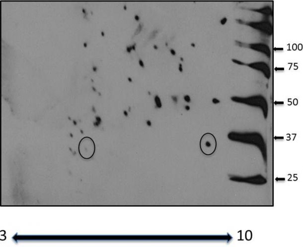 Mouse Galectin‑4 Antibody AF2128