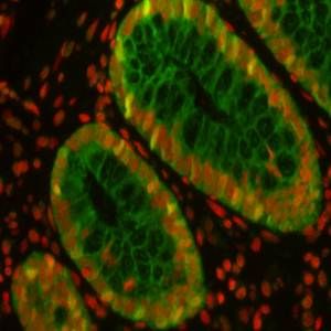 Mouse Galectin‑4 Antibody AF2128