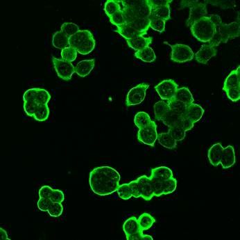 Mouse Galectin‑4 Antibody AF2128