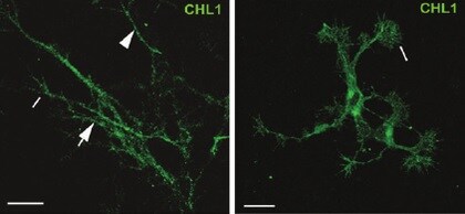 Mouse CHL‑1/L1CAM‑2 Antibody AF2147