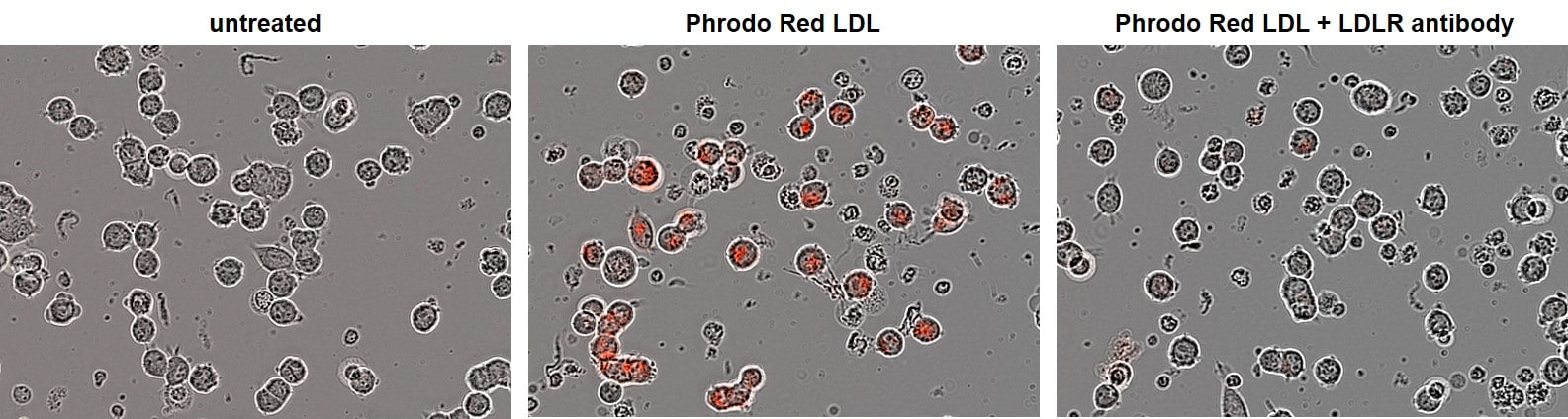 Human LDLR Antibody AF2148