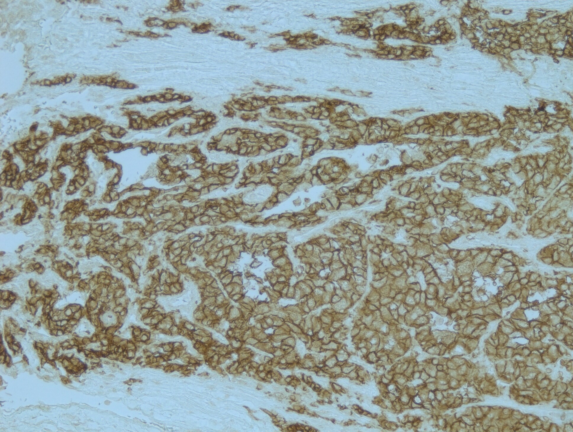 Human Carbonic Anhydrase IX/CA9 Antibody AF2188