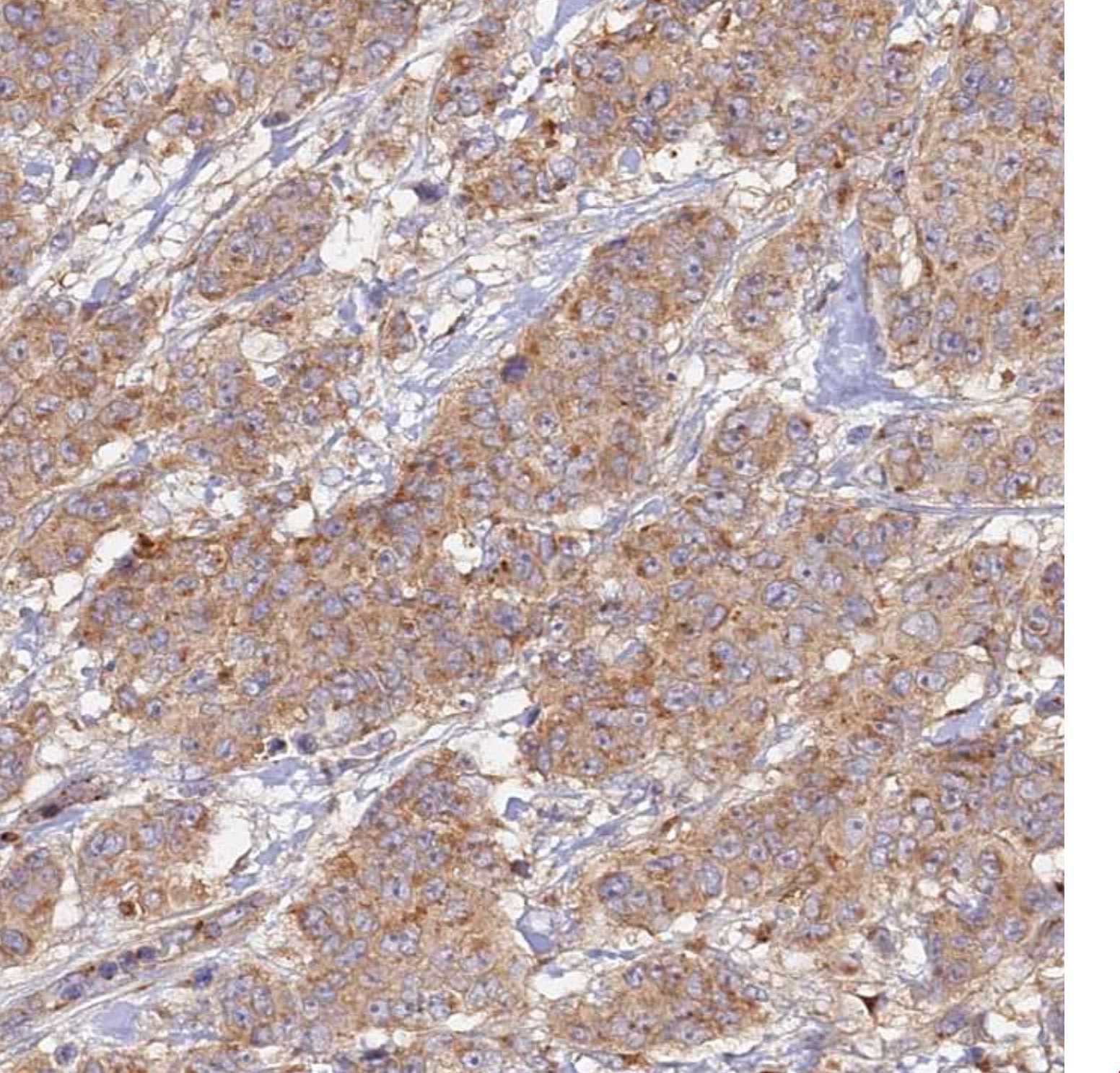 Mouse HGF Antibody AF2207