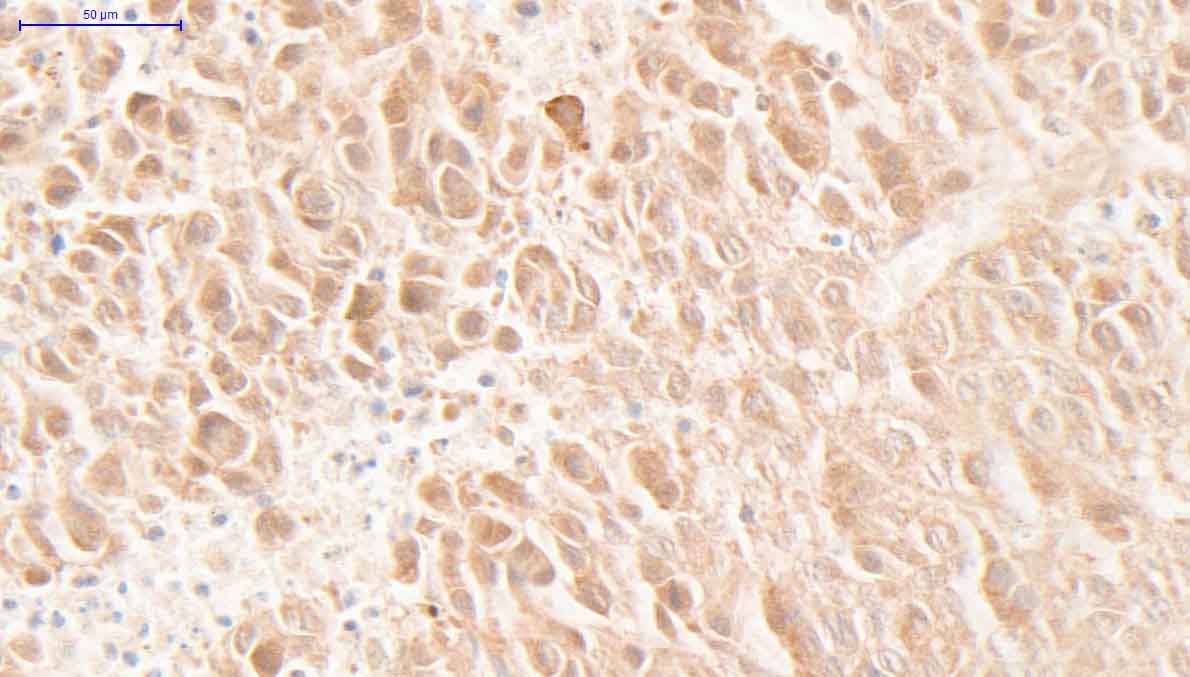 Human Phospho-Axl (Y779) Antibody AF2228