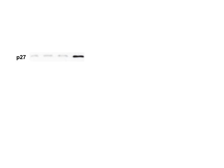 Human/Mouse/Rat p27/Kip1 Antibody AF2256