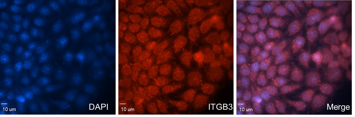 Human Integrin  beta 3/CD61 Antibody AF2266