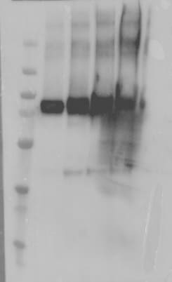Mouse Crossveinless‑2/CV‑2 Antibody AF2299