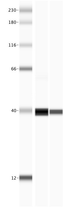 Human MBL Antibody AF2307