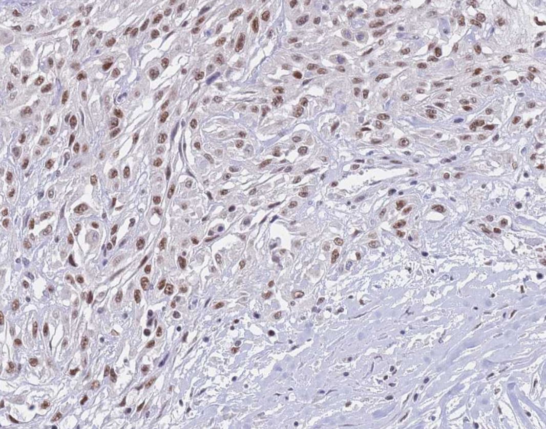 Human Smad8 Antibody AF2309