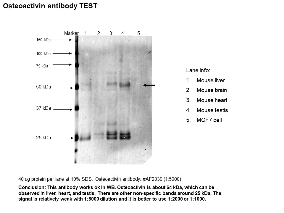 Mouse Osteoactivin/GPNMB Antibody AF2330