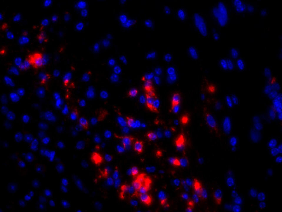 Mouse Osteoactivin/GPNMB Antibody AF2330