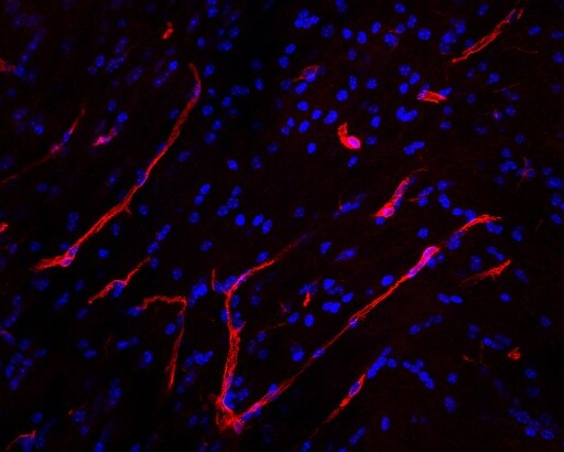 Mouse Aminopeptidase N/CD13 Antibody AF2335