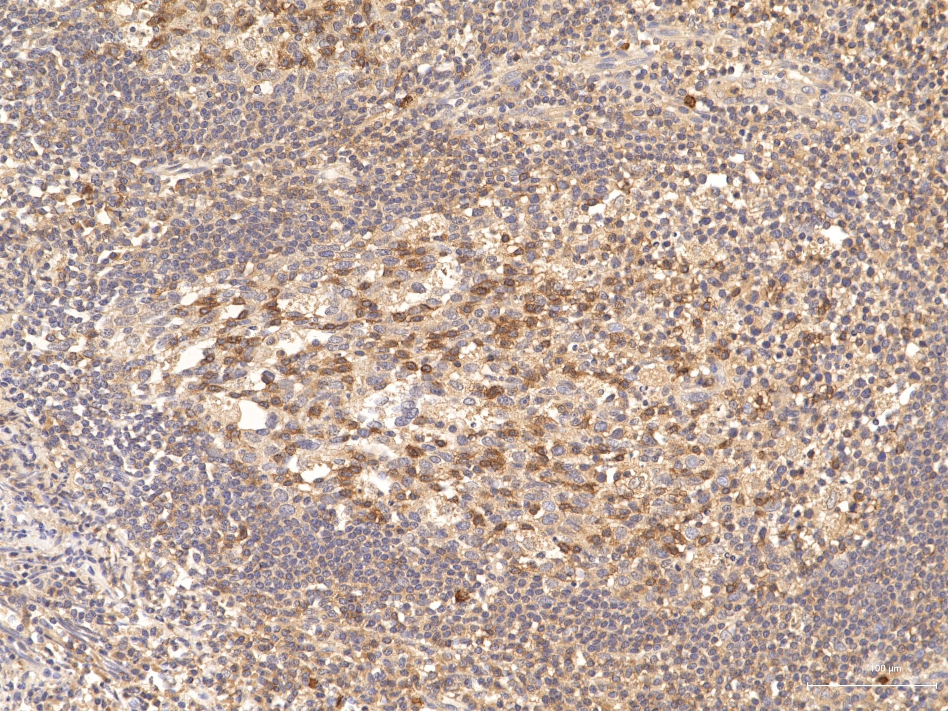 Human CD69 Antibody AF2359