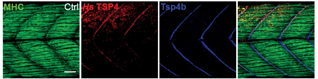 Human Thrombospondin‑4 Antibody AF2390
