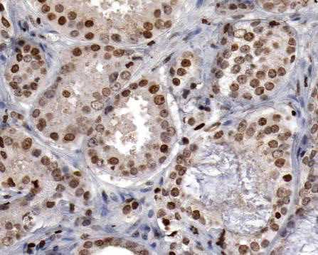 Human HNF‑3 beta /FoxA2 Antibody AF2400