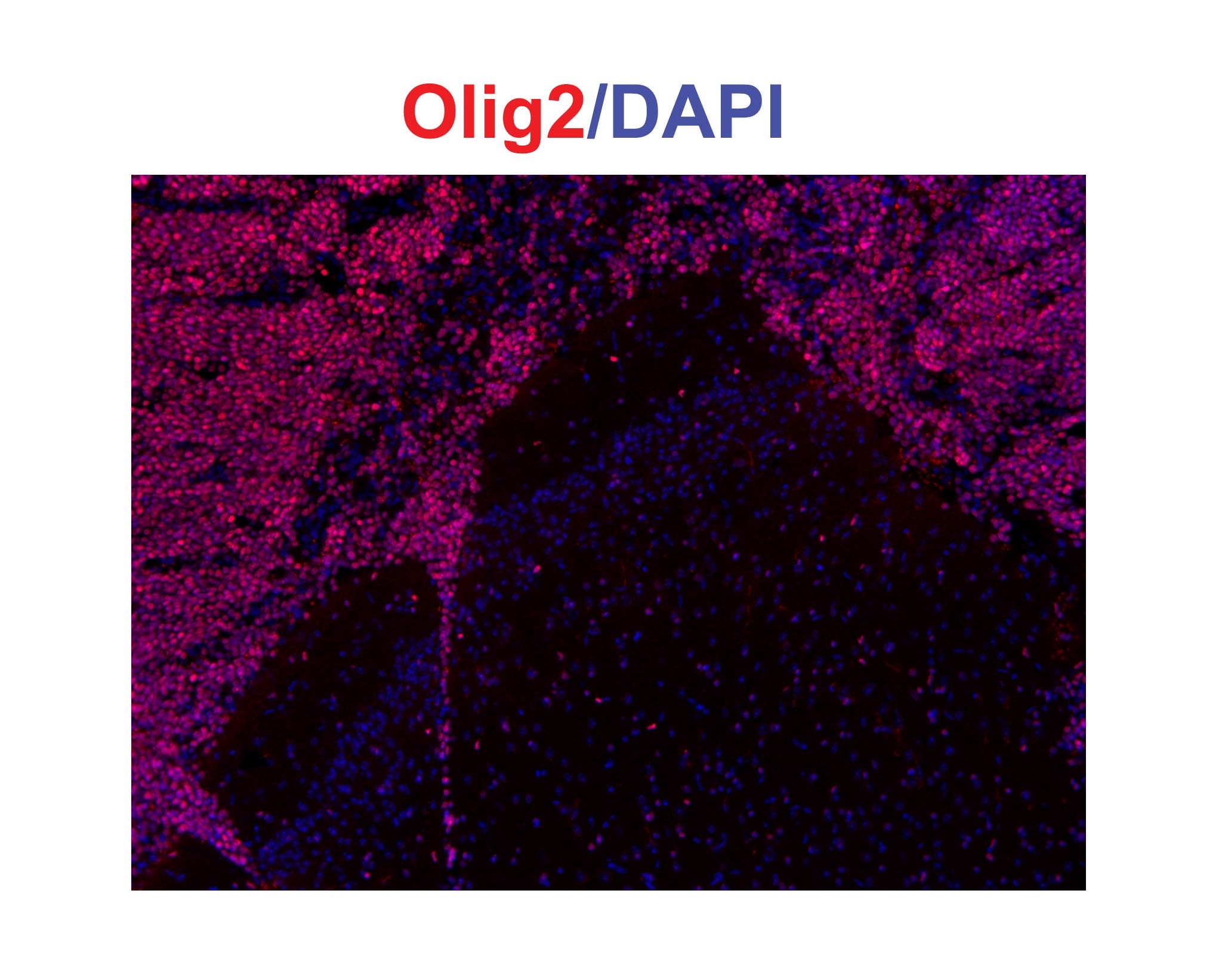 Human/Mouse/Rat Olig2 Antibody AF2418