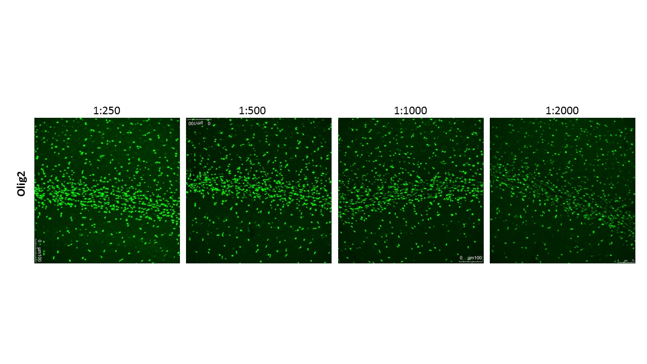 Human/Mouse/Rat Olig2 Antibody AF2418