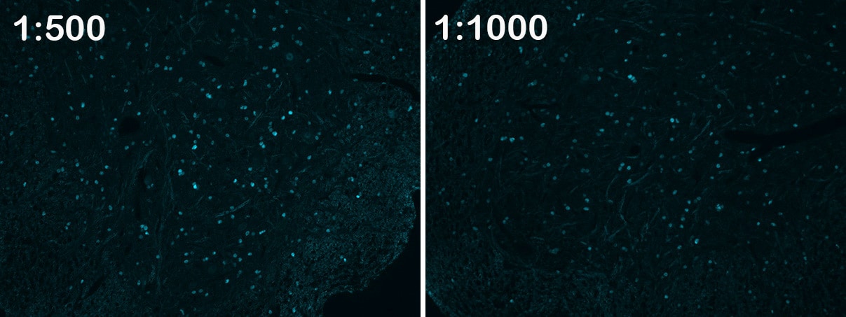 Human/Mouse/Rat Olig2 Antibody AF2418