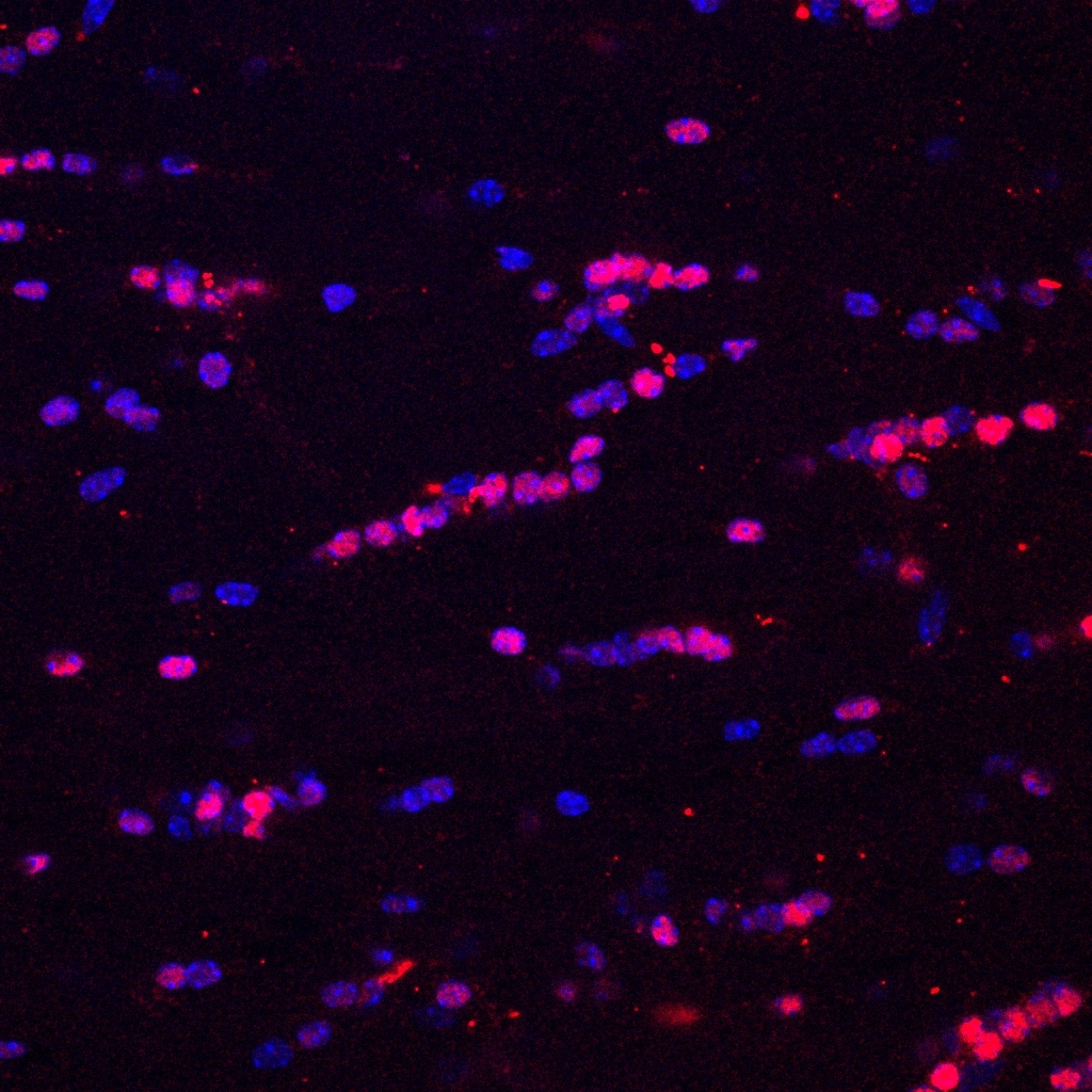 Human/Mouse/Rat Olig2 Antibody AF2418