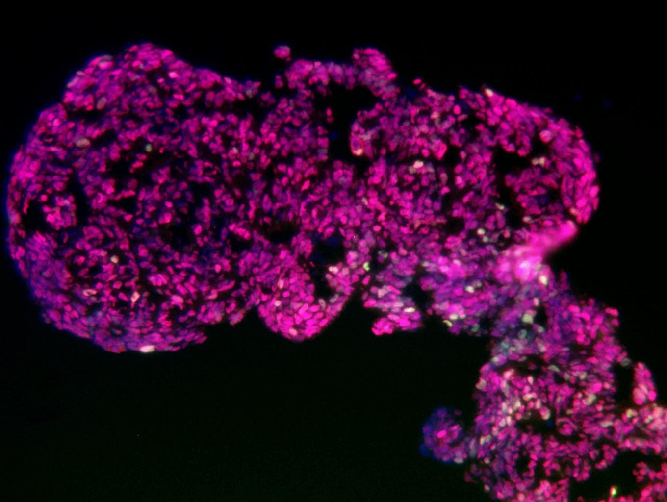 Human PDX‑1/IPF1 Antibody AF2419