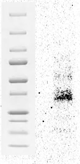 Human Progranulin/PGRN Antibody AF2420