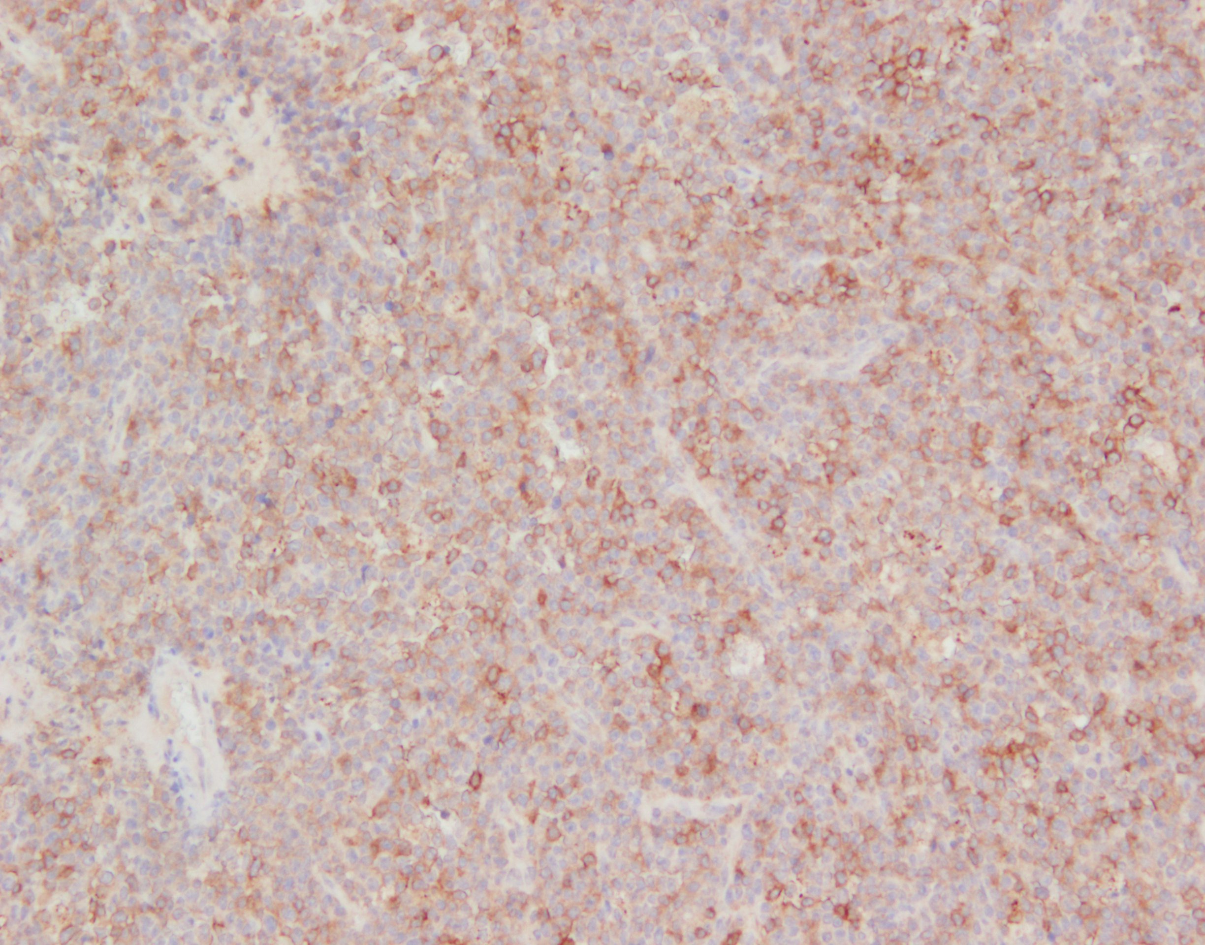 Human FCRL4/FcRH4 Antibody AF2426