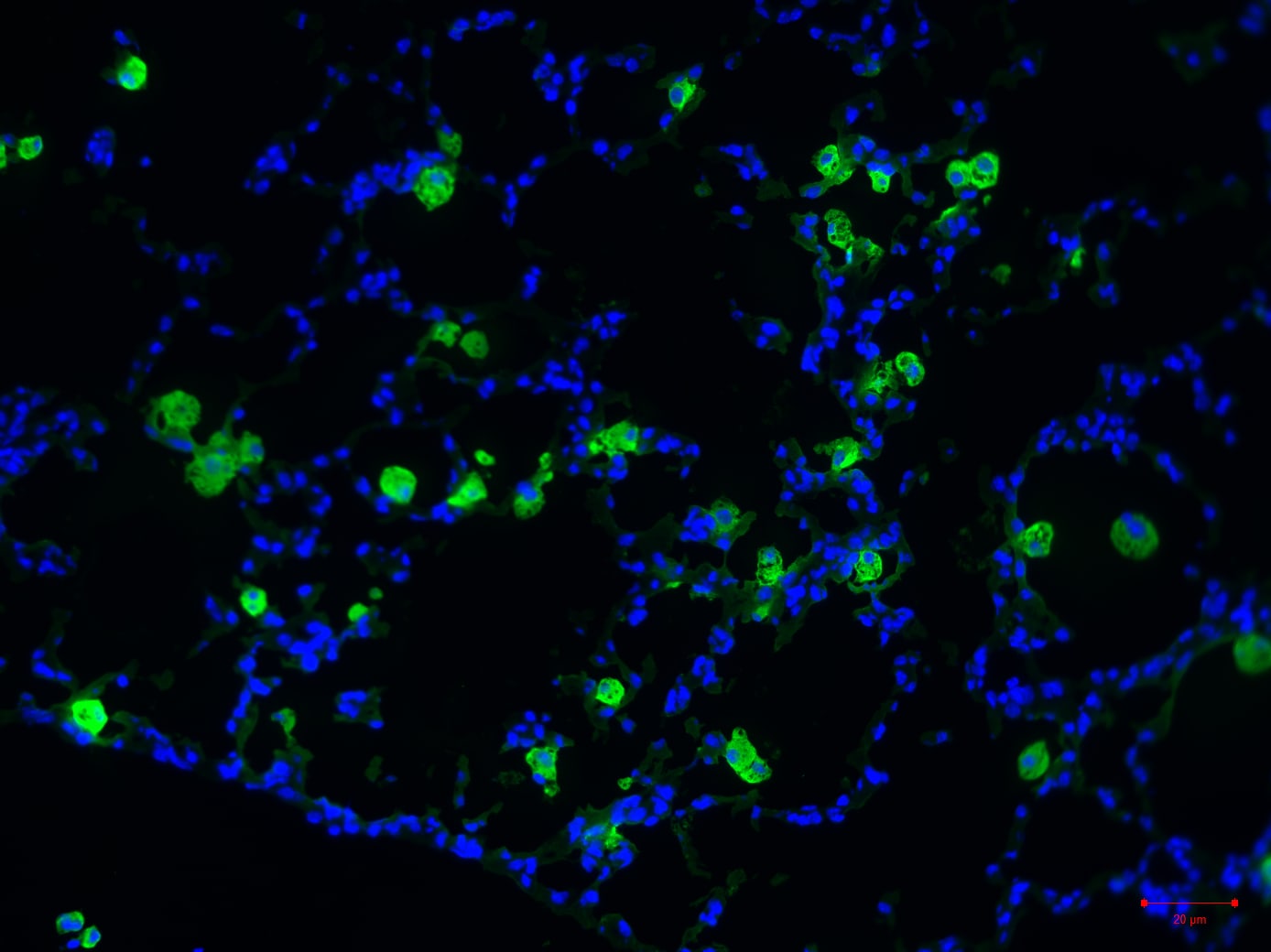 Mouse YM1/Chitinase 3-like 3 Antibody AF2446