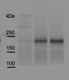 Human Pappalysin‑1/PAPP‑A Antibody AF2487