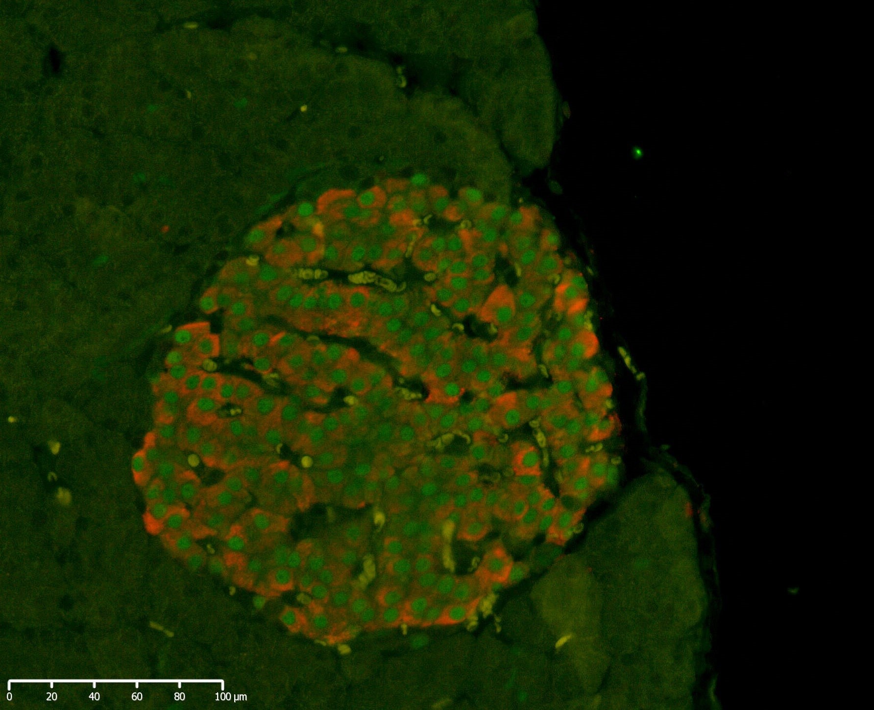 Mouse/Rat PDX‑1/IPF1 Antibody AF2517