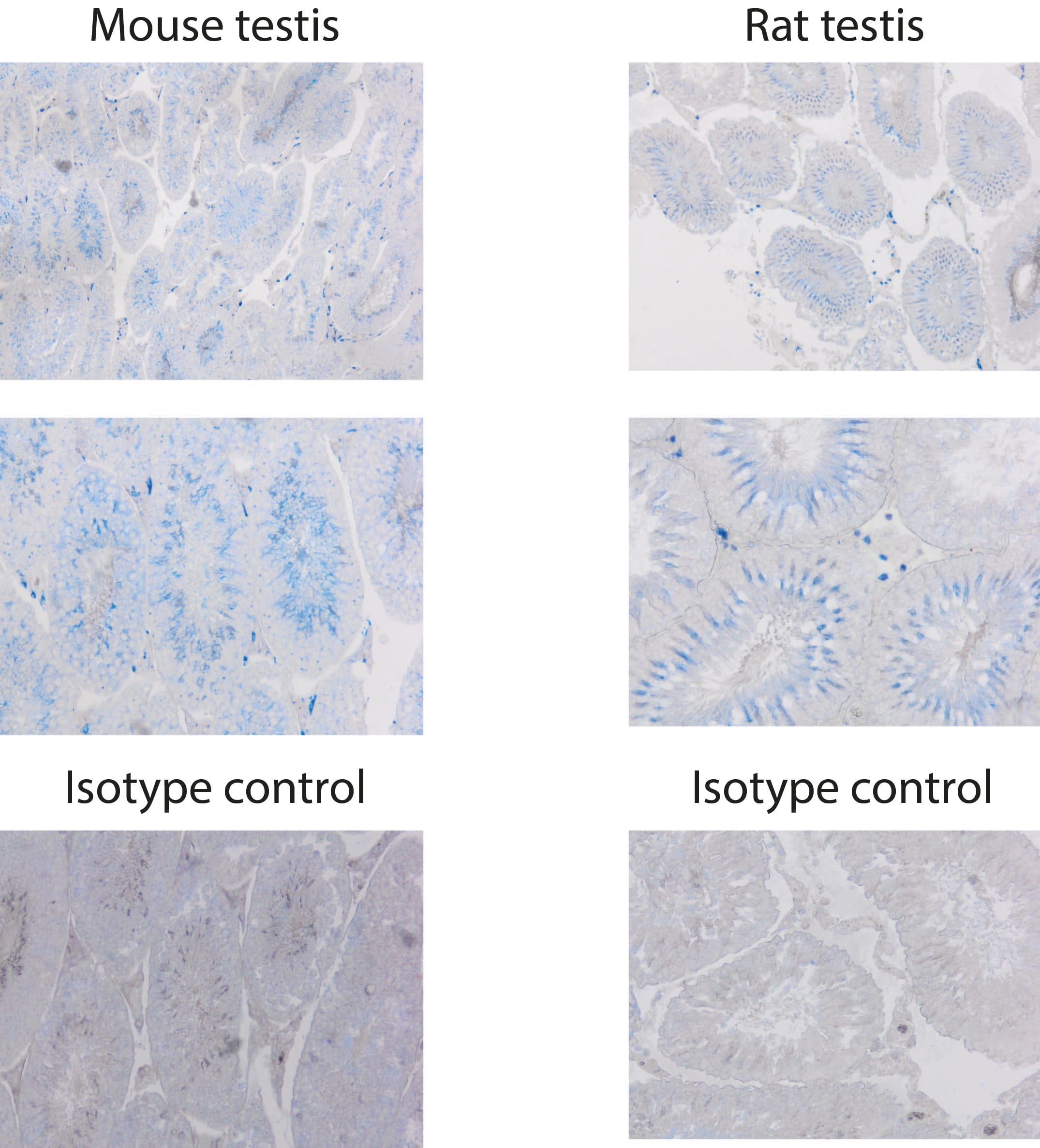 Mouse MMR/CD206 Antibody AF2535