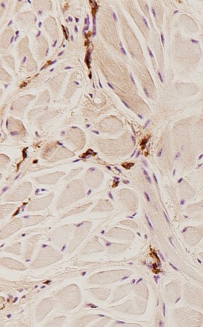 Mouse MMR/CD206 Antibody AF2535