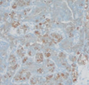 Human Osteoactivin/GPNMB Antibody AF2550