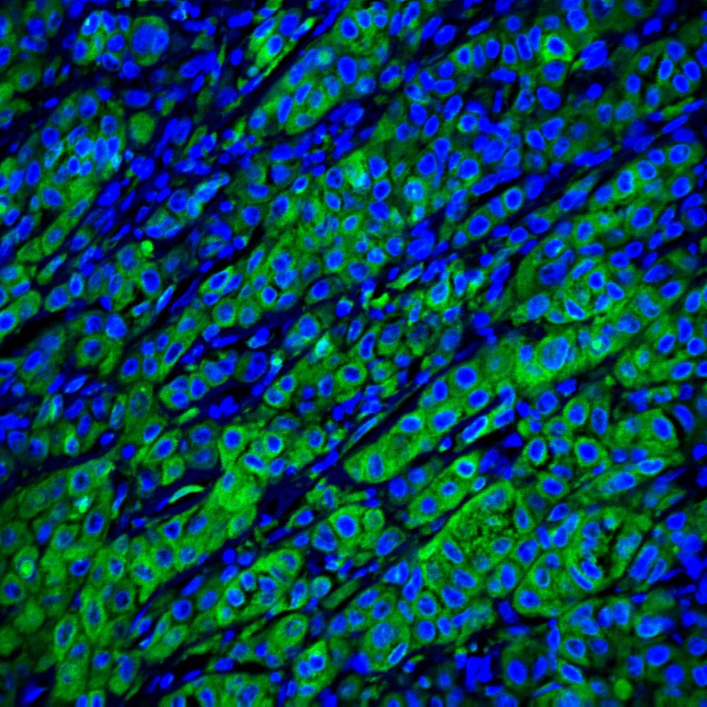 Human Osteoactivin/GPNMB Antibody AF2550