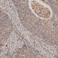 Mouse Progranulin/PGRN Antibody AF2557